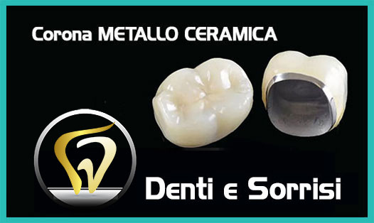 Dentista-all-on-four-prezzi a Cirò Marina-1