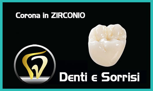 Dentista-all-on-four-prezzi a Brunico-2