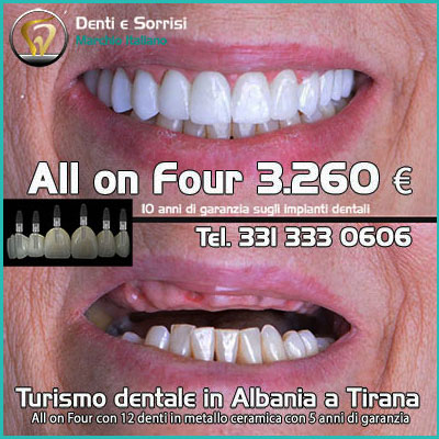Dentista-all-on-four-prezzi a Sorso 25