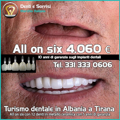 Dentista-all-on-four-prezzi a Cento 26