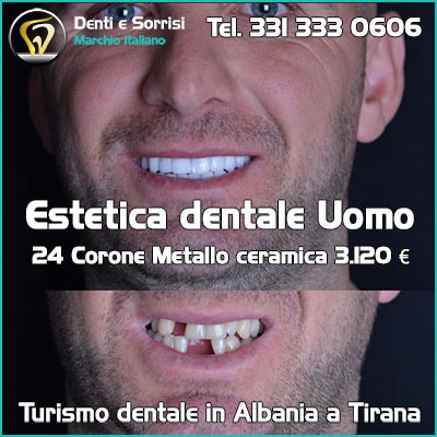 Dentista-all-on-four-prezzi a Città Di Castello 28