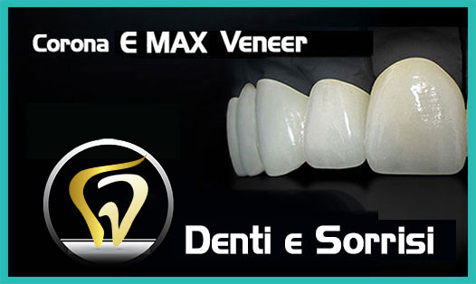 Dentista-all-on-four-prezzi a Cosenza 3