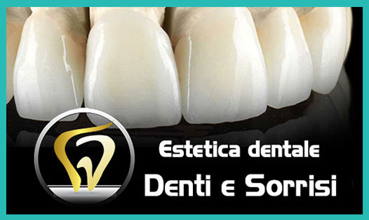 Dentista-all-on-four-prezzi a Potenza Picena 4