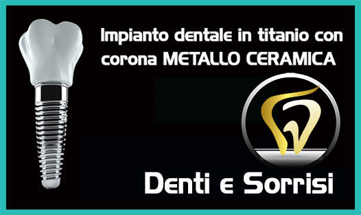 Dentista-all-on-four-prezzi a Legnano 5