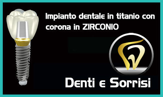 Dentista-all-on-four-prezzi a Brunico 6