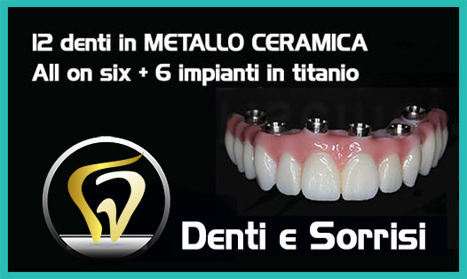 Dentista-all-on-four-prezzi a Cirò Marina 8