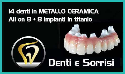 Dentista-all-on-four-prezzi a Legnano 9
