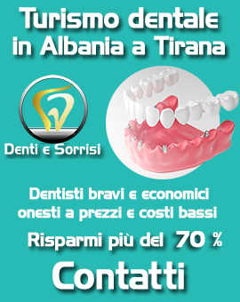 Dentista-all-on-four-prezzi economico bravo onesto low cost clinica dentale a prezzi bassi