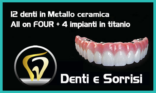 Dentista-all-on-six-prezzi-a-Montalto Uffugo 7