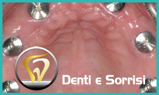 Dentista-estetico-a-Ronchi dei Legionari 10