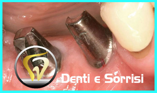 dentista-low-cost-a-durazzo-20