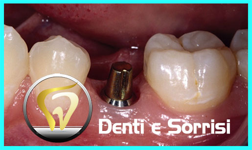 dentista-low-cost-a-durazzo-22