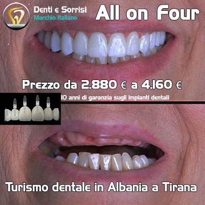 dentista-in-albania-25