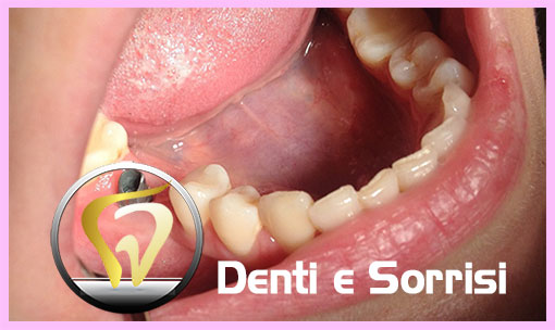dentista-low-cost-in-repubblica-ceca-15