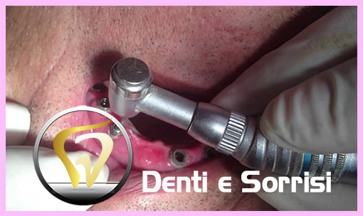 dentista-low-cost-in-repubblica-ceca-18