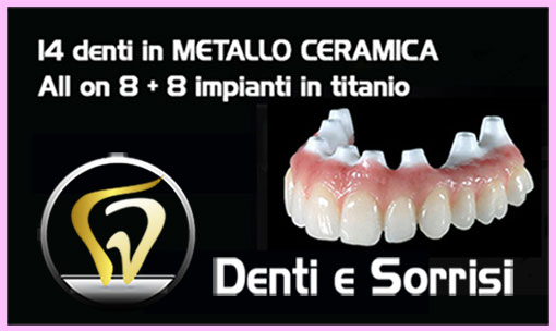 dentista-low-cost-in-repubblica-ceca-9