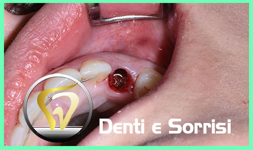dentista-low-cost-serbia-16