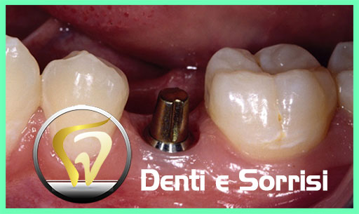 dentista-low-cost-serbia-22