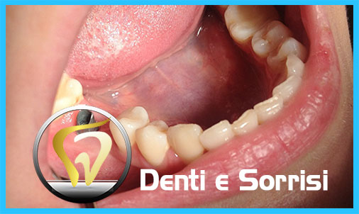 Clinica dentale a Podgorica 15