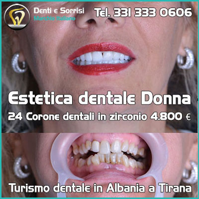 Clinica dentale a Podgorica 27