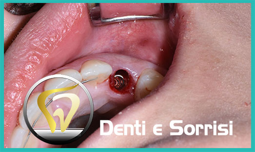 Dentista low cost Formia 16