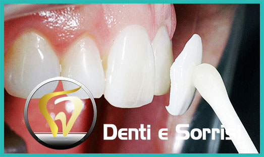 Dentista low cost Formia 17