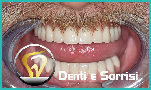 Dentista low cost Formia 24