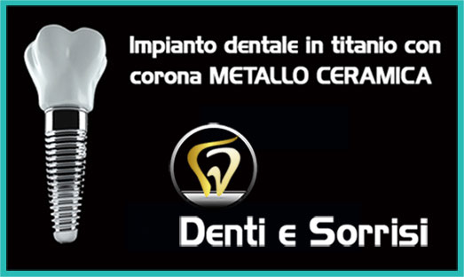 Dentista low cost Formia 5