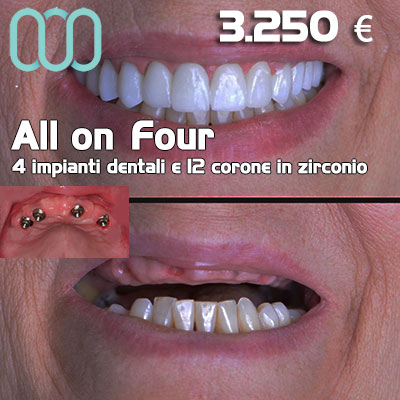 Dentista-per-estetica-dentale-a-Casalnuovo di Napoli 25