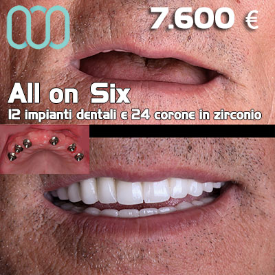 Dentista-per-estetica-dentale-a-Casalnuovo di Napoli 26