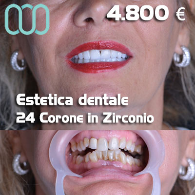 Dentista-per-estetica-dentale-a-Casalnuovo di Napoli 27