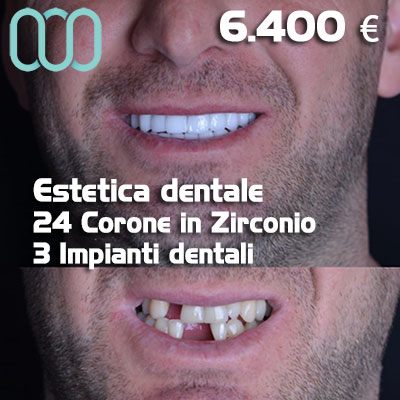 Dentista-per-estetica-dentale-a-Casalnuovo di Napoli 28