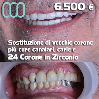 Dentista-per-estetica-dentale-a-Casalnuovo di Napoli 29