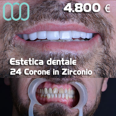 Dentista-per-estetica-dentale-a-Casalnuovo di Napoli 30