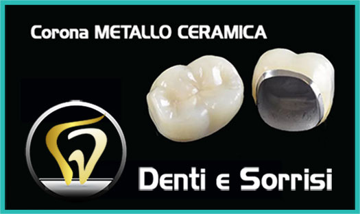 Dentista Lauria prezzi-1