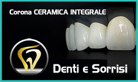 Dentista Trieste prezzi 3