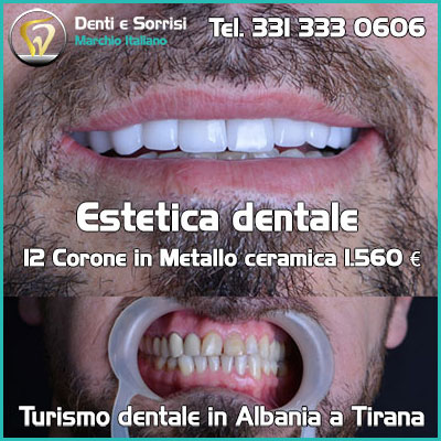 Dentista Penne prezzi 30