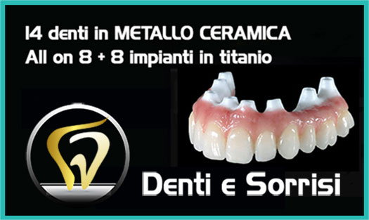 Dentista Muro Lucano prezzi 9