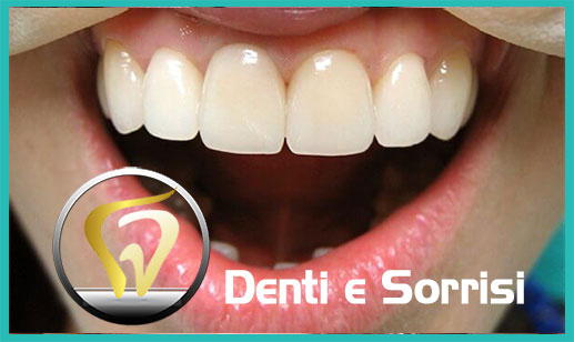 Estetica dentale costo e prezzi a Torino 21