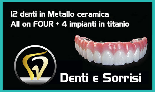 Estetica-dentale-a-Carmagnola 7