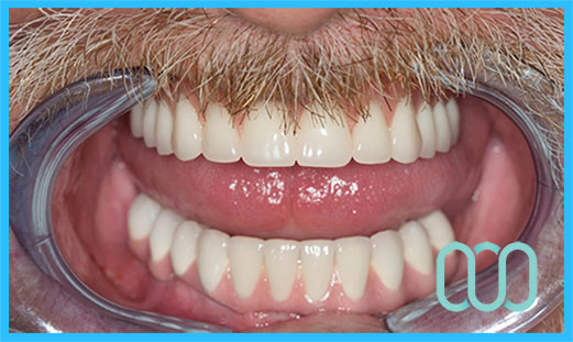 Dentista-estetico-a-Cordenons 24