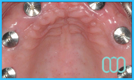 policlinico-odontoiatrico-tirana-10