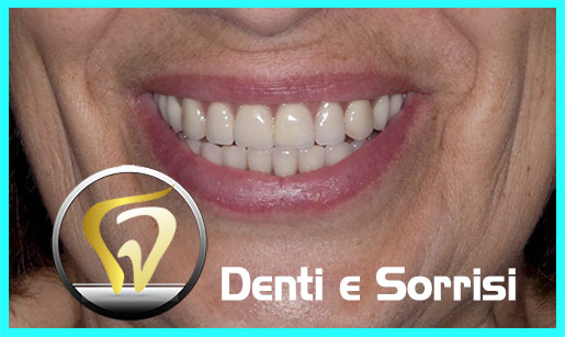 miglior-dentista-odontoiatra-in-albania-12