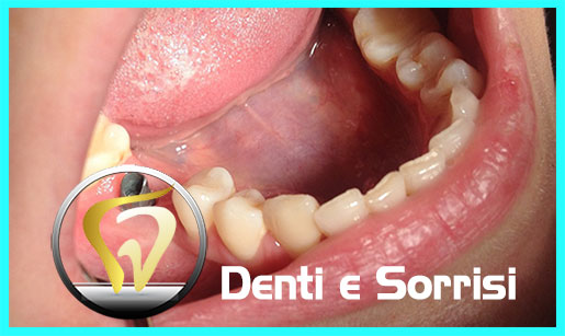 studio-medico-dentista-albania-15