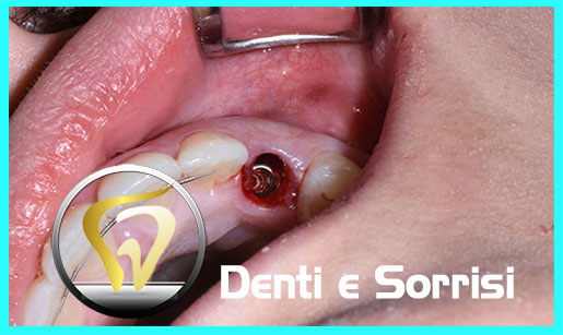 dentista-low-cost-a-valona-16