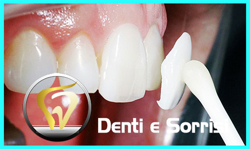 miglior-dentista-odontoiatra-in-albania-17