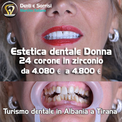 turismo-dentale-durazzo-27