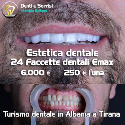 turismo-dentale-durazzo-costi-30