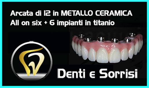 dentista-low-cost-albania-8
