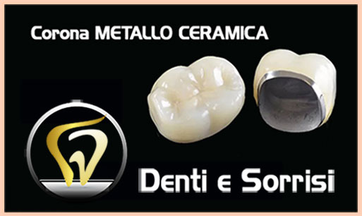 prezzo-corona-in-ceramica-zirconio-1